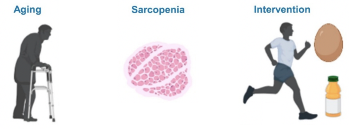 Expression of Telomeric Repeat–Containing RNA Decreases in Sarcopenia and Increases after Exercise and Nutrition Intervention